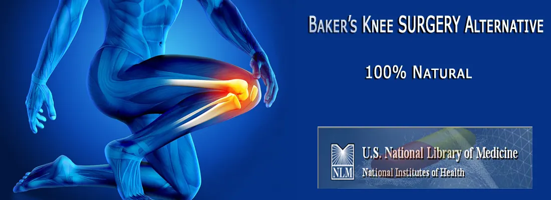 Baker's Knee Cyst SURGERY Natural Alternative B-Relief SUPER Caps: INFO bakerstreatment.com